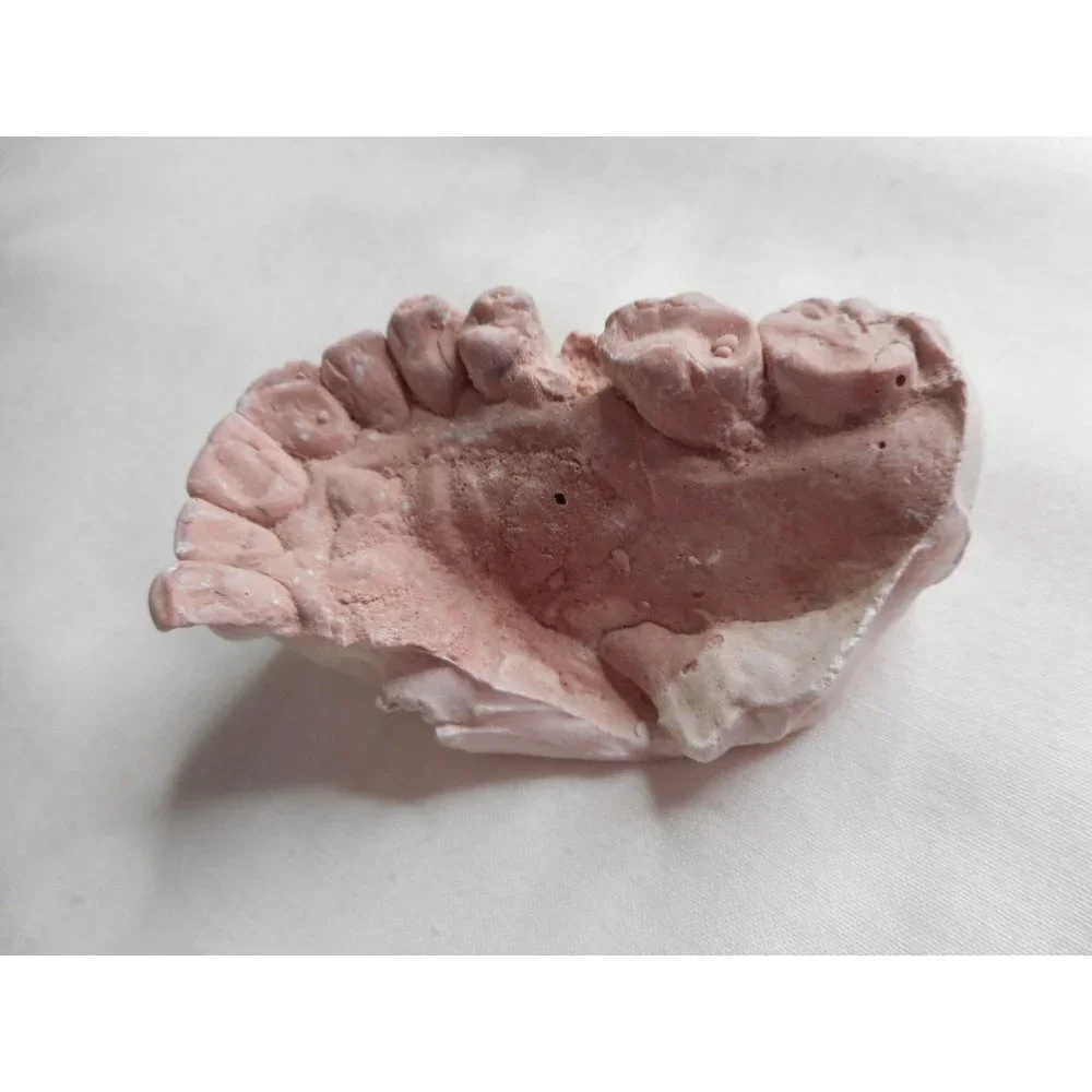 Vintage Cast Dental Teeth Mold Tooth Castings #11 - Picture 3 of 5